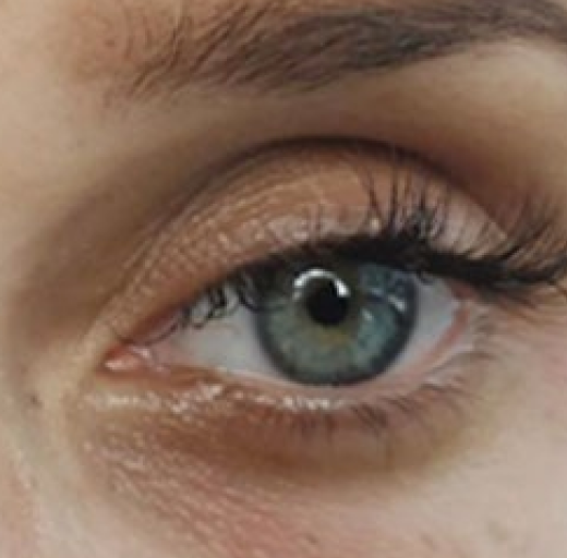 Before/After Image